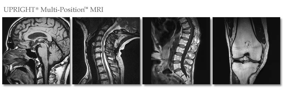 FONAR Upright MRI